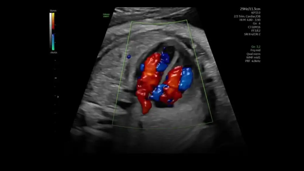 csm_color_doppler_2ab7b61ae5