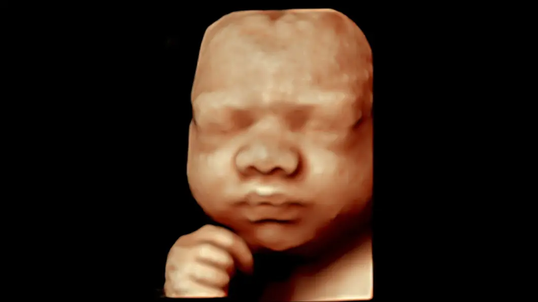csm_fetal_face_6806e25845