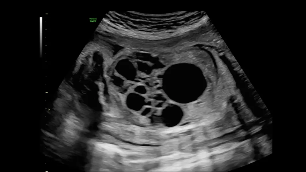 csm_fetal_kidney_b7a755a373